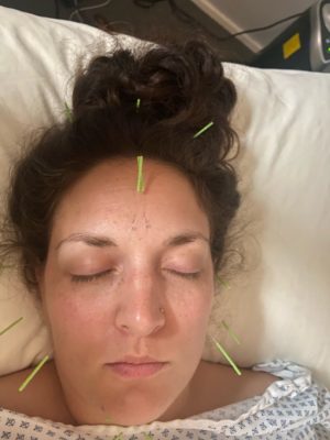 Close up image of light-skinned woman with peachy-olive complexion and dark hair in a messy bun on top of her head. Her eyes are closed and several acupuncture needles with neon yellowish-green ends stick out from her forehead and sides of her cheeks. Smaller intradermal needles that look like teeny silver balls are also visible along the forehead and between the eyebrows. The top of a hospital type gown is also slightly in the frame.